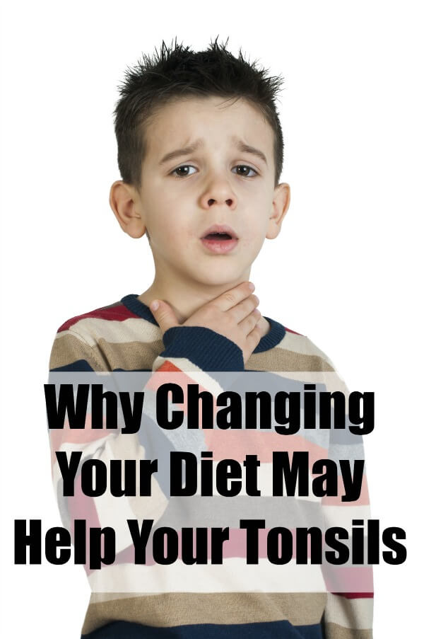 Why Changing Your Diet May Help Your Tonsils